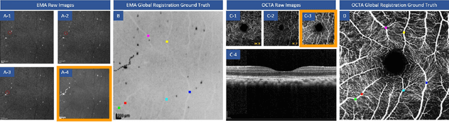 Figure 2 for MEMO: Dataset and Methods for Robust Multimodal Retinal Image Registration with Large or Small Vessel Density Differences