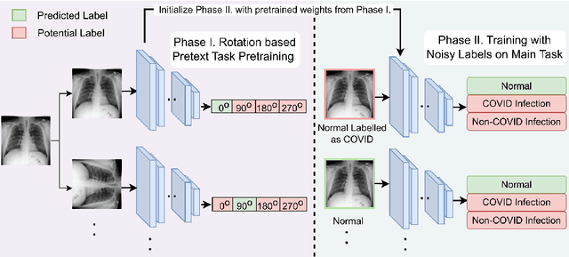 Figure 1 for Improving Medical Image Classification in Noisy Labels Using Only Self-supervised Pretraining