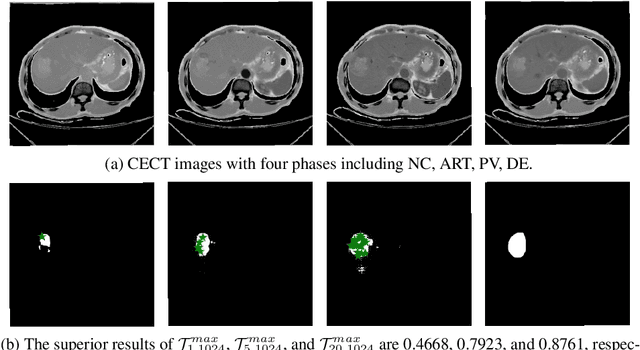 Figure 1 for When SAM Meets Medical Images: An Investigation of Segment Anything Model (SAM) on Multi-phase Liver Tumor Segmentation