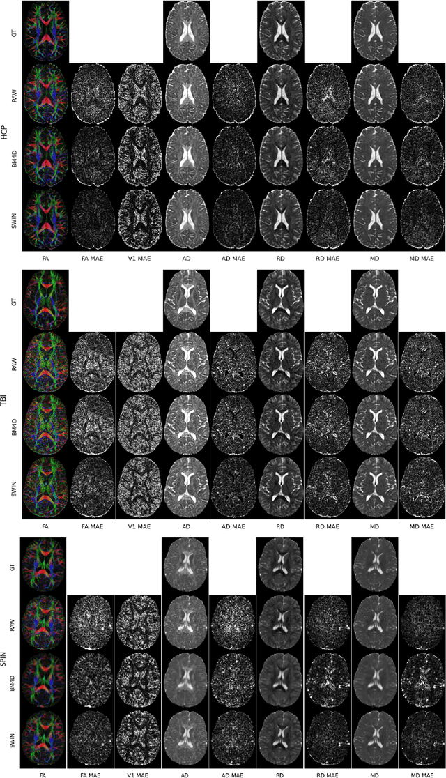 Figure 3 for Generalized Diffusion MRI Denoising and Super-Resolution using Swin Transformers