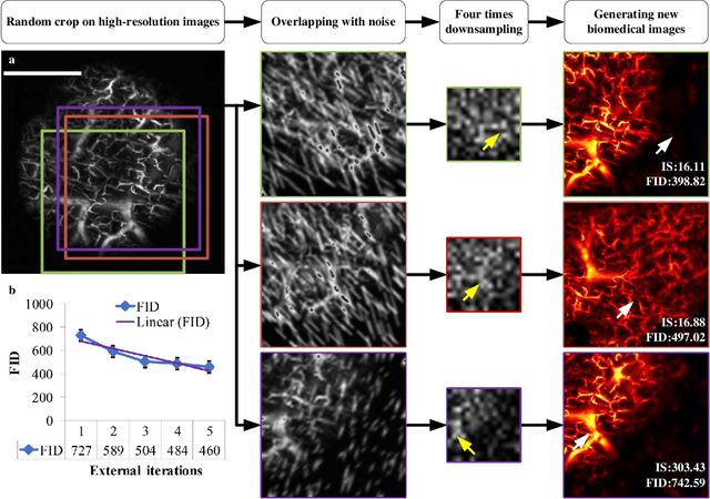 Figure 2 for Iterative-in-Iterative Super-Resolution Biomedical Imaging Using One Real Image