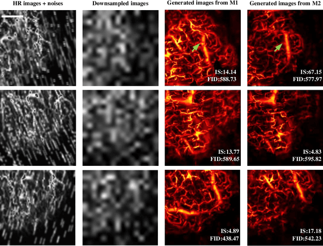 Figure 3 for Iterative-in-Iterative Super-Resolution Biomedical Imaging Using One Real Image