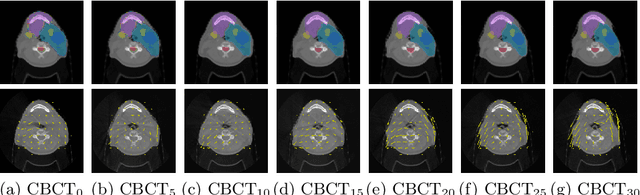Figure 3 for Comparing 3D deformations between longitudinal daily CBCT acquisitions using CNN for head and neck radiotherapy toxicity prediction