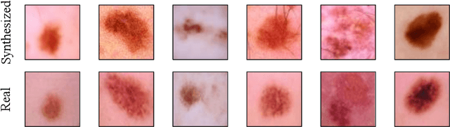 Figure 4 for Iterative Online Image Synthesis via Diffusion Model for Imbalanced Classification