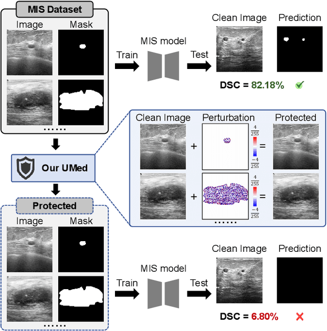 Figure 1 for Safeguarding Medical Image Segmentation Datasets against Unauthorized Training via Contour- and Texture-Aware Perturbations