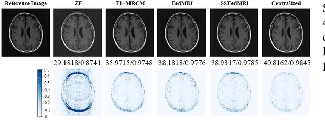 Figure 3 for Self-Supervised Federated Learning for Fast MR Imaging