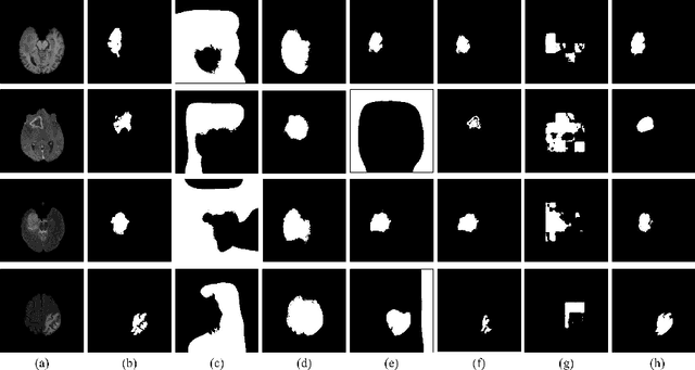Figure 3 for AME-CAM: Attentive Multiple-Exit CAM for Weakly Supervised Segmentation on MRI Brain Tumor