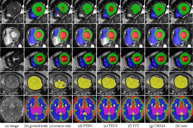 Figure 3 for UPL-SFDA: Uncertainty-aware Pseudo Label Guided Source-Free Domain Adaptation for Medical Image Segmentation