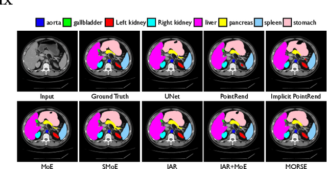 Figure 4 for Implicit Anatomical Rendering for Medical Image Segmentation with Stochastic Experts