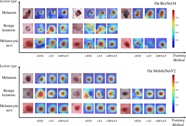 Figure 4 for Dynamic Perturbation-Adaptive Adversarial Training on Medical Image Classification