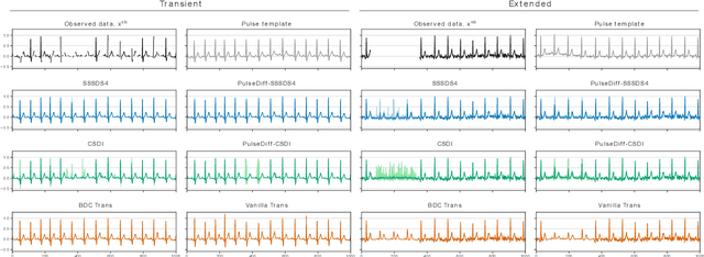 Figure 2 for Improving Diffusion Models for ECG Imputation with an Augmented Template Prior