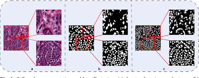 Figure 1 for CausalCellSegmenter: Causal Inference inspired Diversified Aggregation Convolution for Pathology Image Segmentation