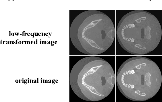 Figure 3 for FDNet: Feature Decoupled Segmentation Network for Tooth CBCT Image