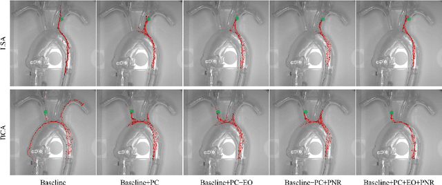 Figure 4 for Image-Guided Autonomous Guidewire Navigation in Robot-Assisted Endovascular Interventions using Reinforcement Learning