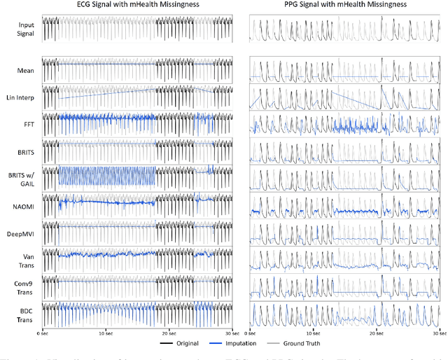 Figure 2 for PulseImpute: A Novel Benchmark Task for Pulsative Physiological Signal Imputation