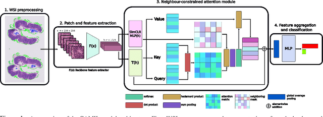 Figure 1 for CAMIL: Context-Aware Multiple Instance Learning for Whole Slide Image Classification