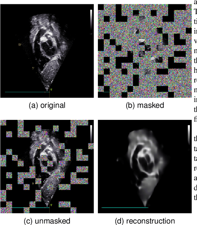 Figure 3 for EDMAE: An Efficient Decoupled Masked Autoencoder for Standard View Identification in Pediatric Echocardiography