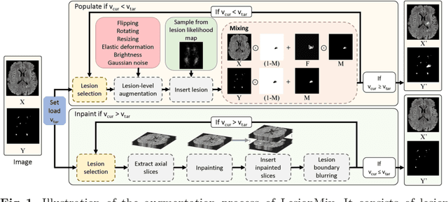 Figure 1 for LesionMix: A Lesion-Level Data Augmentation Method for Medical Image Segmentation