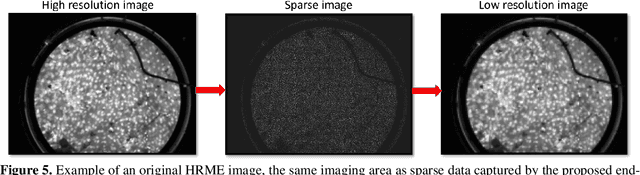 Figure 4 for Deep learning-based image super-resolution of a novel end-expandable optical fiber probe for application in esophageal cancer diagnostics
