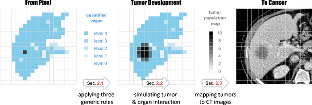 Figure 1 for From Pixel to Cancer: Cellular Automata in Computed Tomography