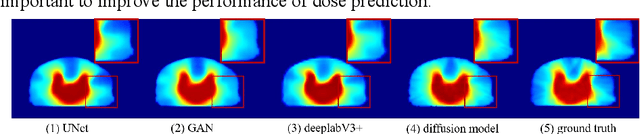 Figure 1 for DiffDP: Radiotherapy Dose Prediction via a Diffusion Model