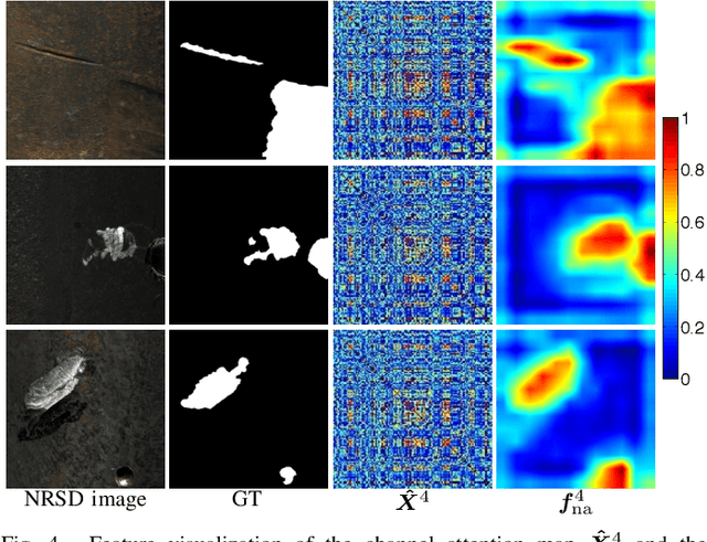 Figure 4 for No-Service Rail Surface Defect Segmentation via Normalized Attention and Dual-scale Interaction