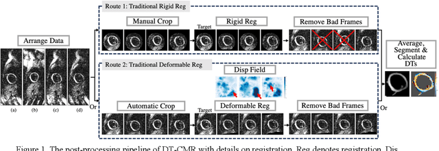Figure 1 for Efficient Post-processing of Diffusion Tensor Cardiac Magnetic Imaging Using Texture-conserving Deformable Registration