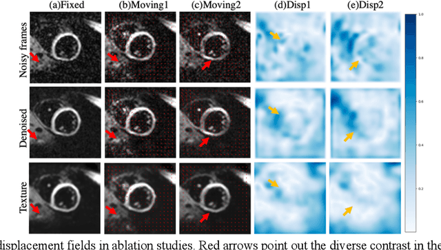 Figure 3 for Efficient Post-processing of Diffusion Tensor Cardiac Magnetic Imaging Using Texture-conserving Deformable Registration