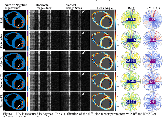 Figure 4 for Efficient Post-processing of Diffusion Tensor Cardiac Magnetic Imaging Using Texture-conserving Deformable Registration