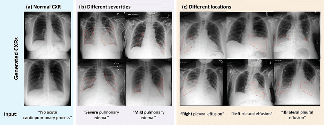 Figure 2 for LLM Itself Can Read and Generate CXR Images