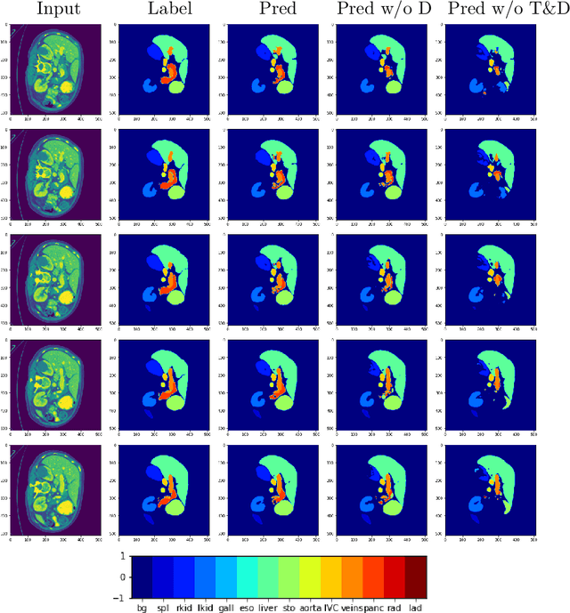 Figure 4 for Adapting Pre-trained Vision Transformers from 2D to 3D through Weight Inflation Improves Medical Image Segmentation