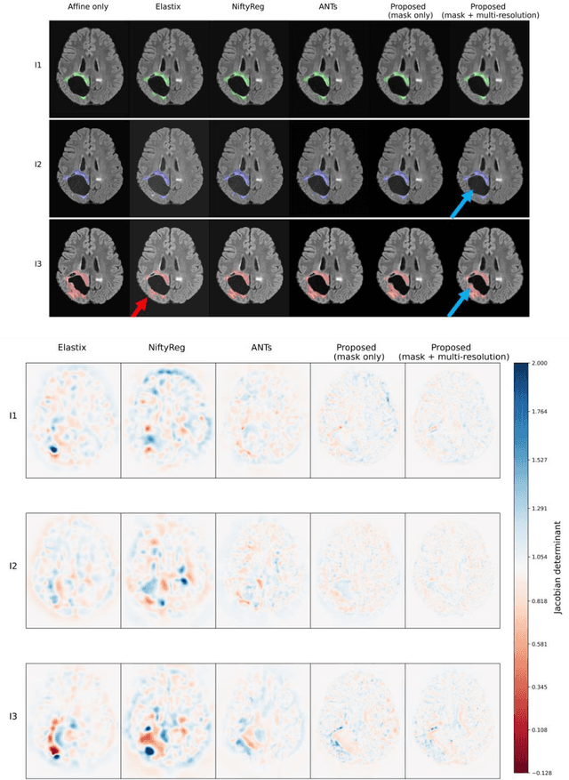 Figure 4 for Deep learning-based group-wise registration for longitudinal MRI analysis in glioma