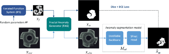 Figure 1 for FractalAD: A simple industrial anomaly segmentation method using fractal anomaly generation and backbone knowledge distillation