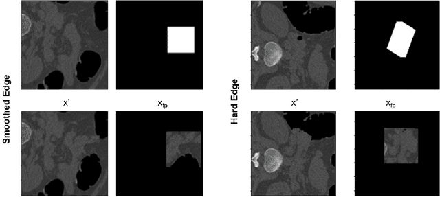 Figure 3 for Harder synthetic anomalies to improve OoD detection in Medical Images