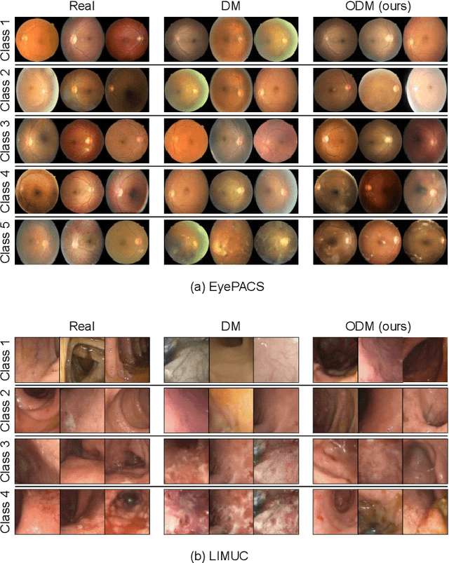 Figure 4 for An Ordinal Diffusion Model for Generating Medical Images with Different Severity Levels