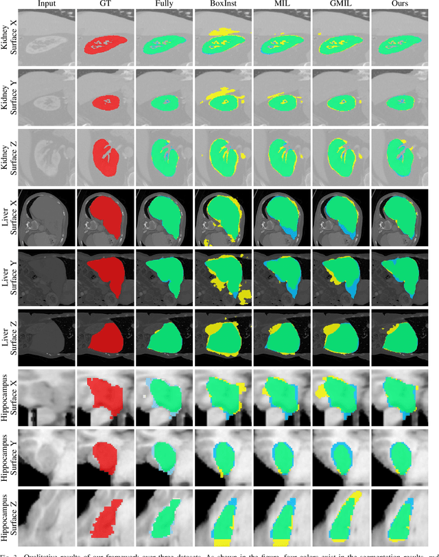 Figure 3 for Weakly-Supervised 3D Medical Image Segmentation using Geometric Prior and Contrastive Similarity