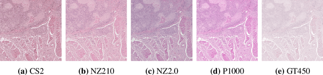 Figure 1 for Multi-Scanner Canine Cutaneous Squamous Cell Carcinoma Histopathology Dataset