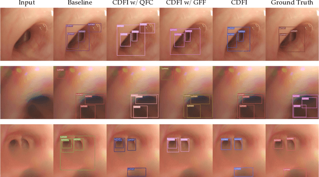 Figure 4 for CDFI: Cross Domain Feature Interaction for Robust Bronchi Lumen Detection