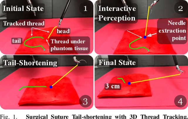 Figure 1 for Self-Supervised Learning for Interactive Perception of Surgical Thread for Autonomous Suture Tail-Shortening
