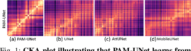 Figure 1 for PAM-UNet: Shifting Attention on Region of Interest in Medical Images