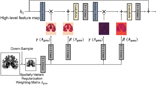 Figure 1 for Conditional Deformable Image Registration with Spatially-Variant and Adaptive Regularization