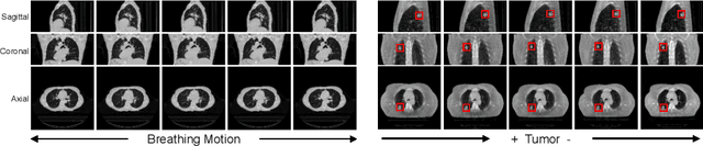 Figure 2 for Explicit Temporal Embedding in Deep Generative Latent Models for Longitudinal Medical Image Synthesis