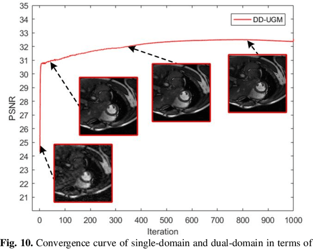 Figure 2 for Universal Generative Modeling in Dual-domain for Dynamic MR Imaging