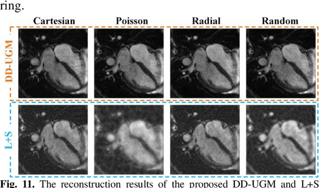 Figure 3 for Universal Generative Modeling in Dual-domain for Dynamic MR Imaging