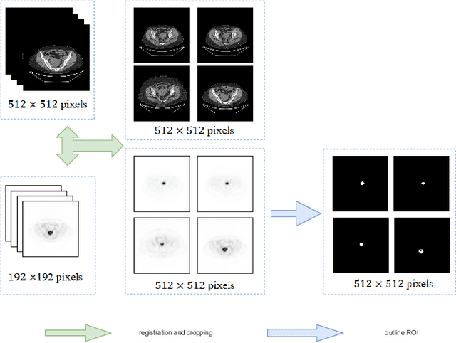 Figure 3 for ECPC-IDS:A benchmark endometrail cancer PET/CT image dataset for evaluation of semantic segmentation and detection of hypermetabolic regions