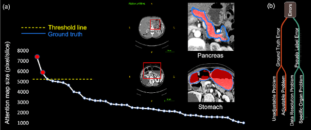 Figure 4 for Annotating 8,000 Abdominal CT Volumes for Multi-Organ Segmentation in Three Weeks