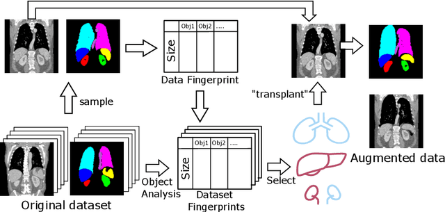 Figure 2 for AnatoMix: Anatomy-aware Data Augmentation for Multi-organ Segmentation