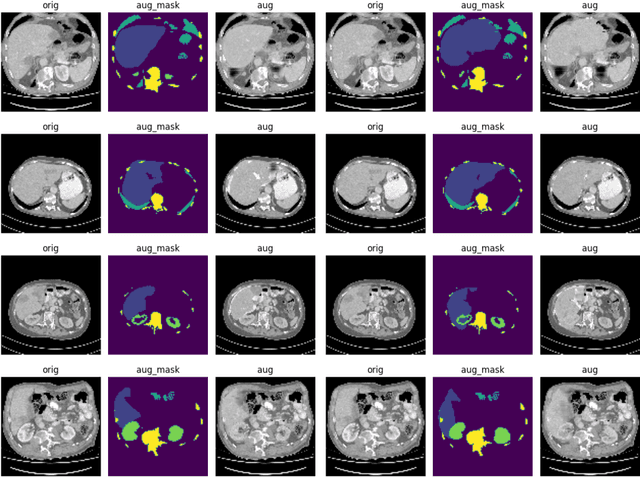 Figure 3 for AnatoMix: Anatomy-aware Data Augmentation for Multi-organ Segmentation