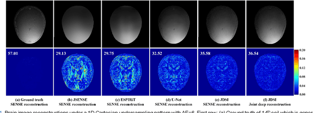 Figure 1 for A Faithful Deep Sensitivity Estimation for Accelerated Magnetic Resonance Imaging