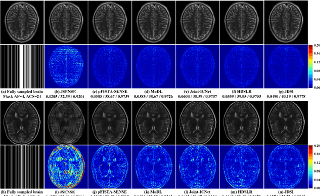 Figure 3 for A Faithful Deep Sensitivity Estimation for Accelerated Magnetic Resonance Imaging